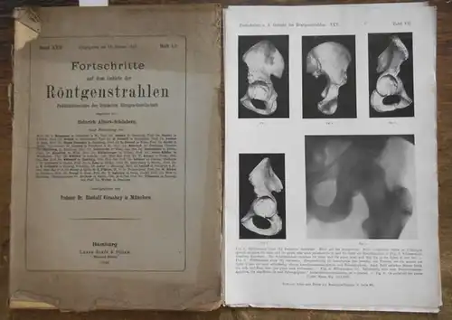 Röntgenstrahlen. - Grashey, Rudolf Prof.Dr.  (Hrsg.): Röntgenstrahlen,  Fortschritte auf dem Gebiete der.  Band XXX, Heft 1/2 ,  15. Januar 1923. Publikationsorgan der Deutschen Röntgen-Gesellschaft, begr.  Von Heinrich Albers-Schönberg. 