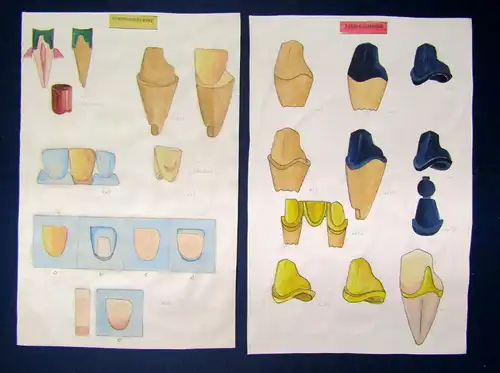 Sammlung 5 Zeichnungen von Zahn - Kronen um 1970 Zahnheilkunde Technik sf